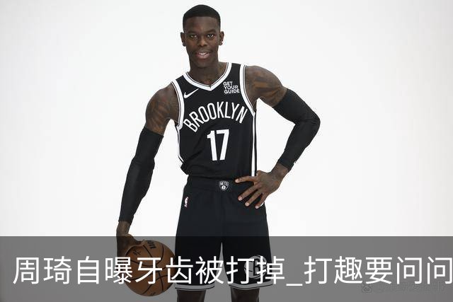 周琦自曝牙齿被打掉 打趣要问问“云总”算不算工伤？
